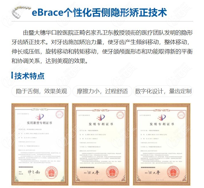 ebrace舌侧矫正的原理及特点